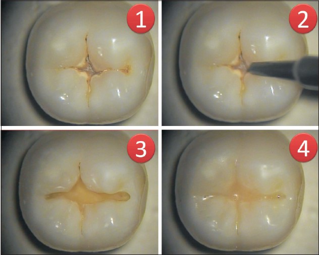 Εικόνα Σφράγισμα