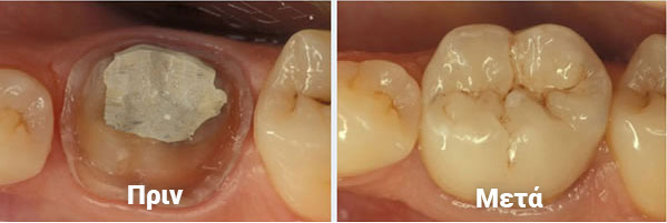 Οδοντική Χειρουργική